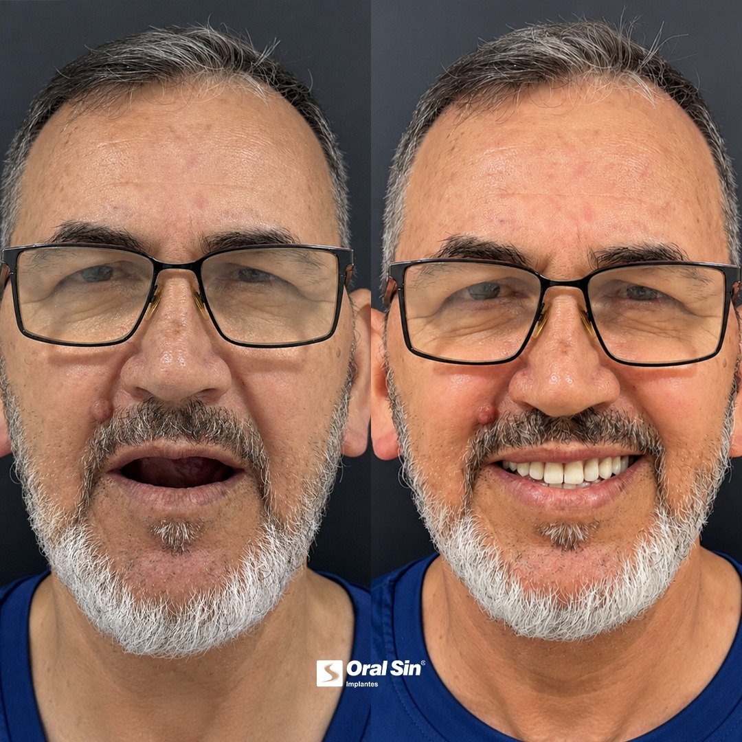Caso 5 - Transformação de sorriso